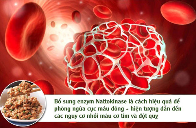 Nattokinase enzyme phòng ngừa cục máu đông