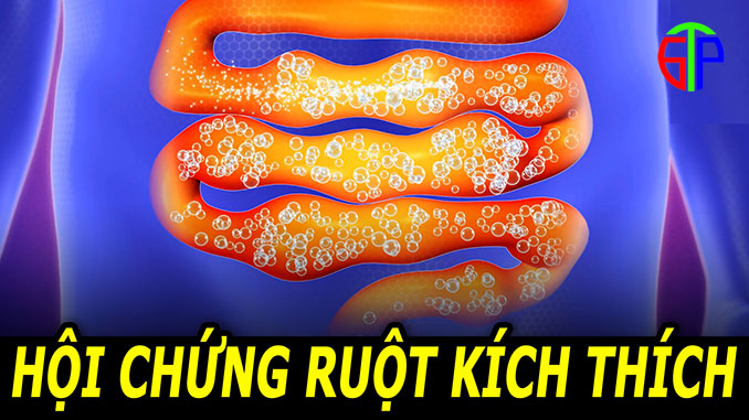 Nguyên nhân hội chứng ruột kích thích